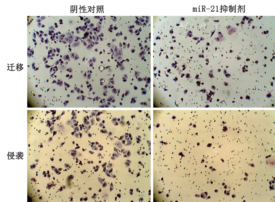 光镜下观察transwell技术检测mir–21抑制剂及阴性对照对乳腺癌细胞
