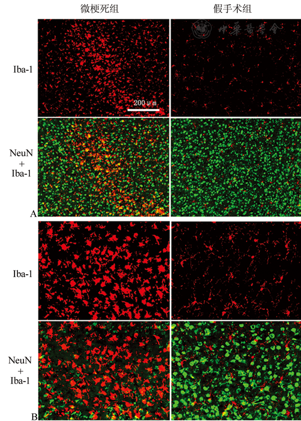 双光子显微镜飞秒激光照射建立小鼠大脑皮质微梗死模型
