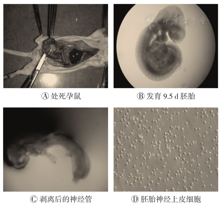 神经管畸形小鼠胚胎神经上皮细胞的黏弹性特性