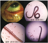 9%),结膜吸吮线虫常寄生在狗和猫的眼部,在这个时期蝇又大量繁