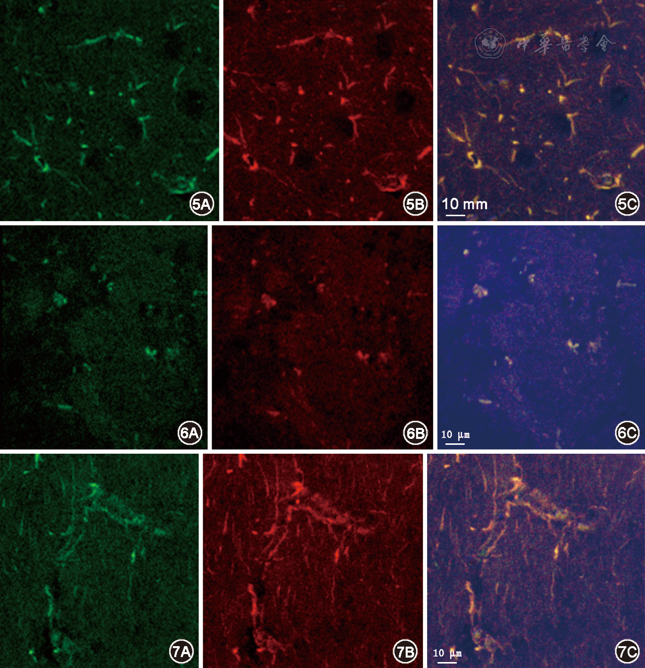 brdu fitc染色为绿荧光;5b.tubulin cy3染色为红荧光;5c.