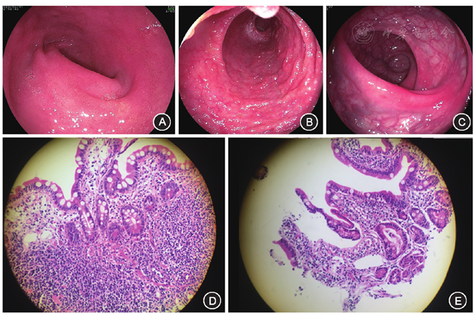 第483例 腹泻—便秘—腹痛—直肠黏膜充血性红斑