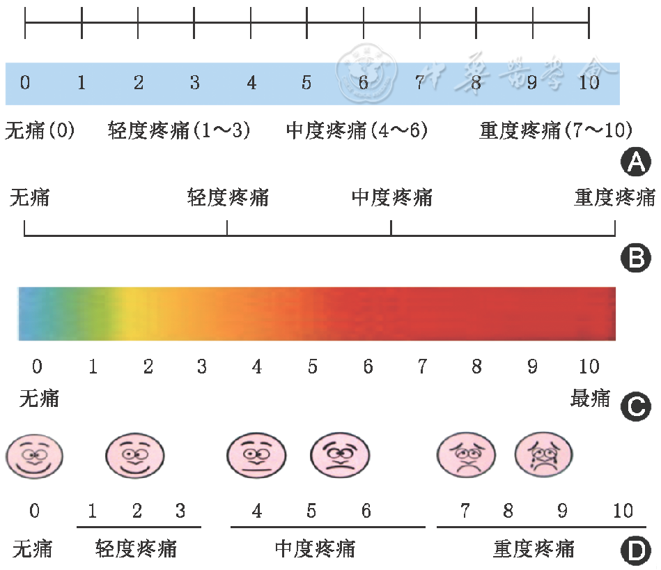 a:数字等级评定量表;b:语言描述量表;c:视觉模拟评分;d:面部表情疼痛