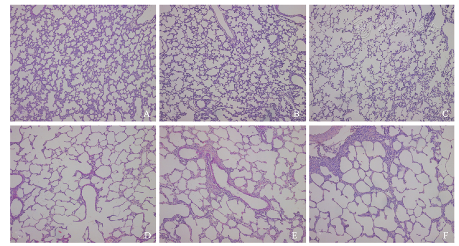 两组大鼠肺组织形态学改变(he染色×100)