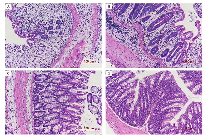点击查看大图 图2 不同组小鼠结肠组织病理学改变(he染色,×200)