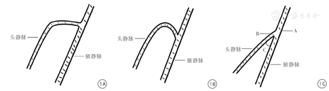 头静脉解剖观察及其临床意义