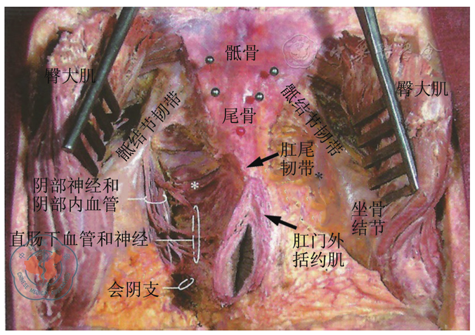 图2 坐骨直肠窝侧壁解剖示意图.