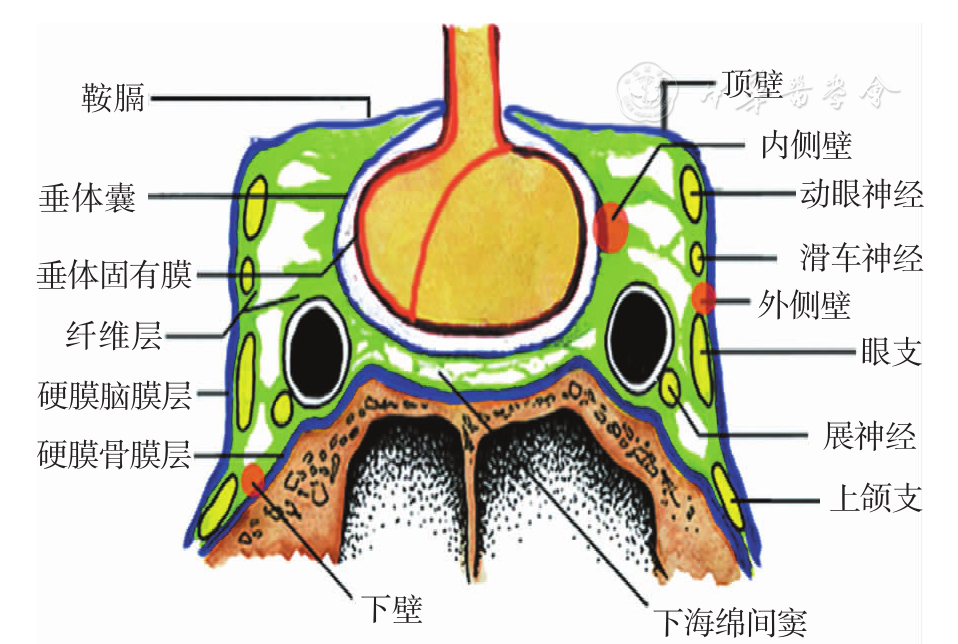 垂体腺瘤相关的膜性结构解剖及其临床意义