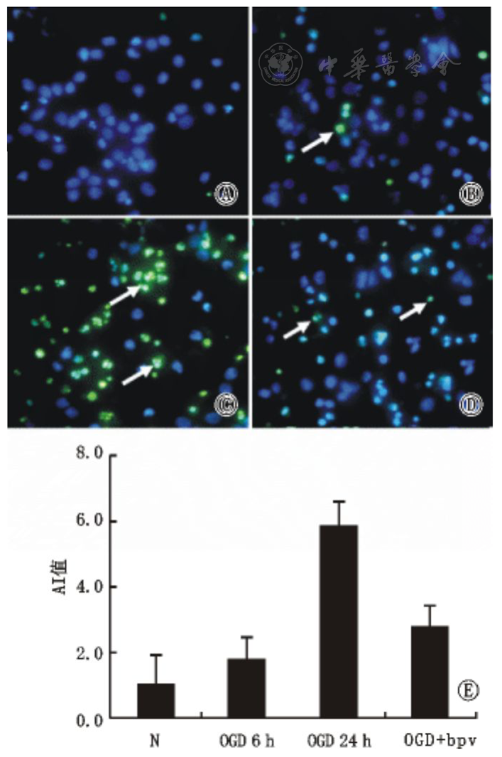 与ogd组比较,bpv干预后神经元凋亡减少( 点击查看大图 图4 tunel染色