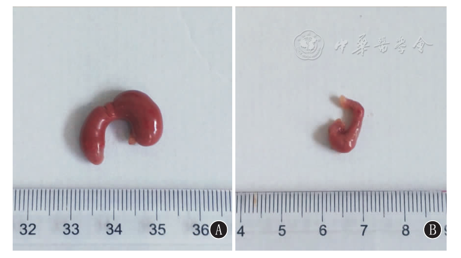 抗生素诱导的菌群紊乱对幼鼠结肠黏膜屏障及免疫反应的影响