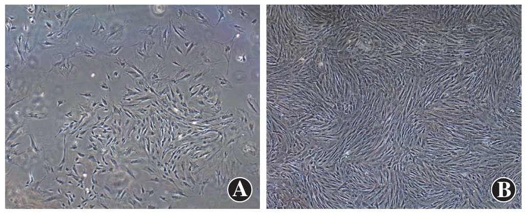 图1 培养的兔bmscs形态特征(×100) a:原代细胞培养7 d,贴壁细胞增加