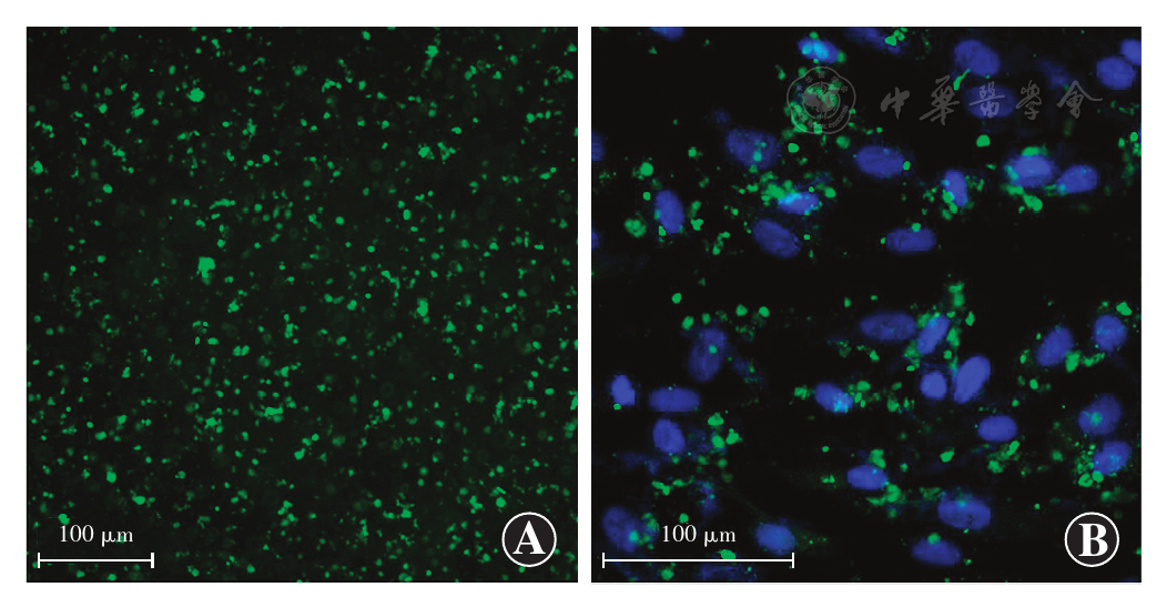 吞入rpe细胞内的pos颗粒(绿色荧光)围绕于dapi染色的细胞核(蓝色荧光)