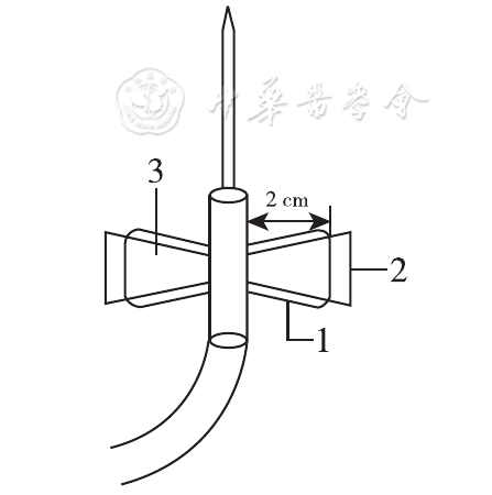 一次性静脉采血针的改良与应用