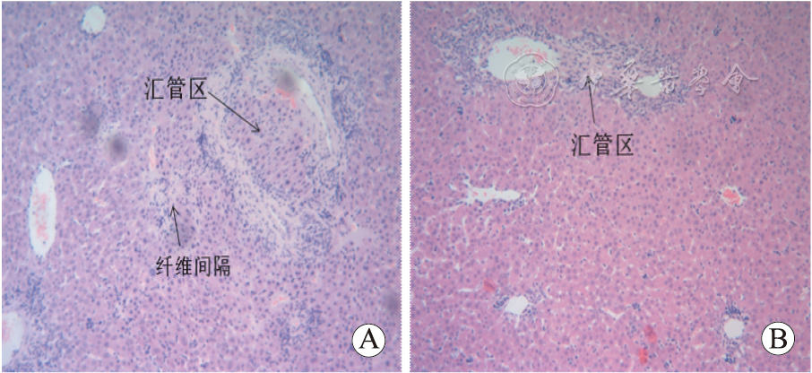 图3 光镜下肝组织病理学改变(苏木精-伊红染色×100 a.