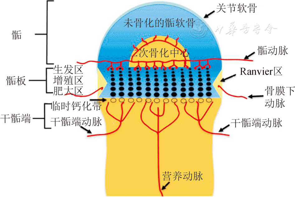 骺板骨桥的发生机制及治疗研究进展