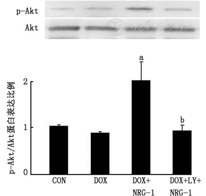 纽兰格林-1通过激活pi3k-akt信号通路减弱阿霉素引起的心肌细胞凋亡