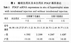 康宁克通或干扰素局部注射对瘢痕pdgfbb基因表达影响