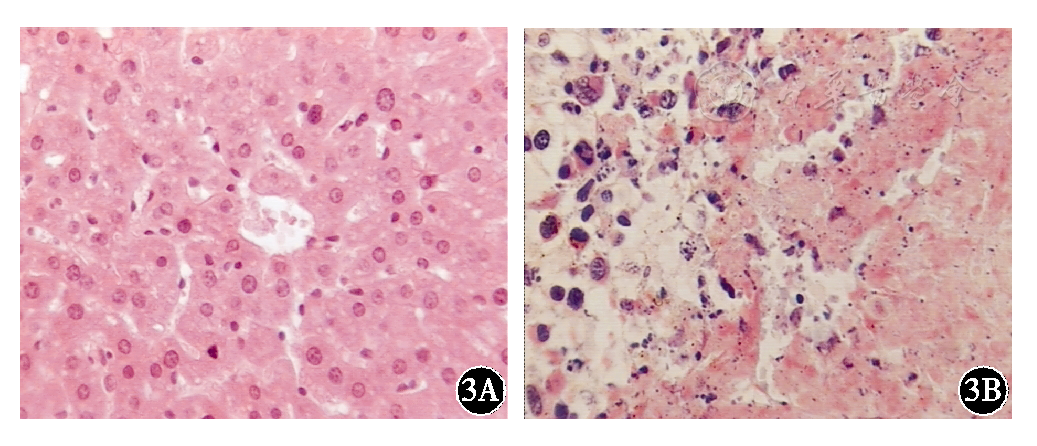 正常小鼠和hepa细胞原位肝癌荷瘤小鼠肝组织细胞形态 he ×250