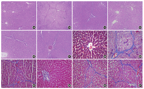 汇管区及肝组织内无胶原纤维形成;b组大鼠肝实质被破坏,肝小叶结构